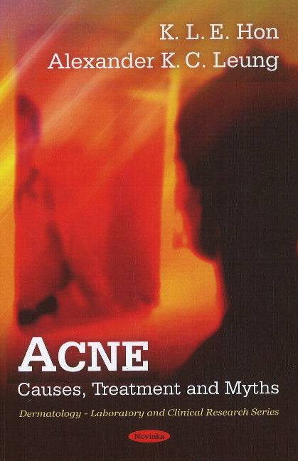 Acne