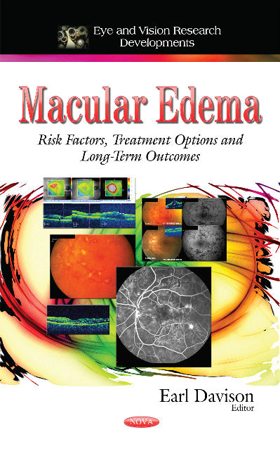 Macular Edema
