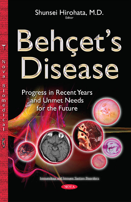 Behçets Disease