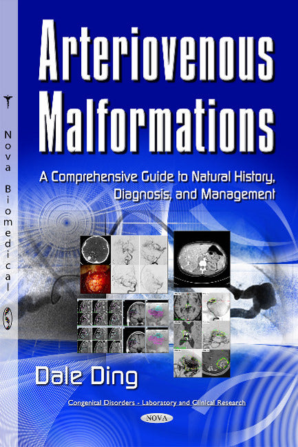 Arteriovenous Malformations