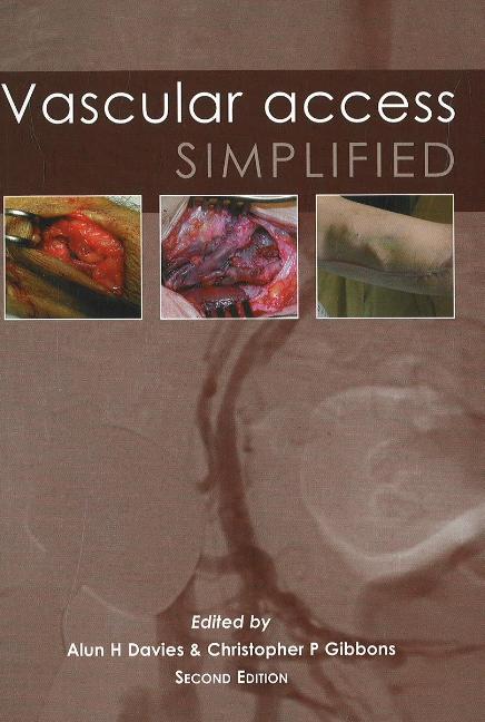 Vascular Access Simplified