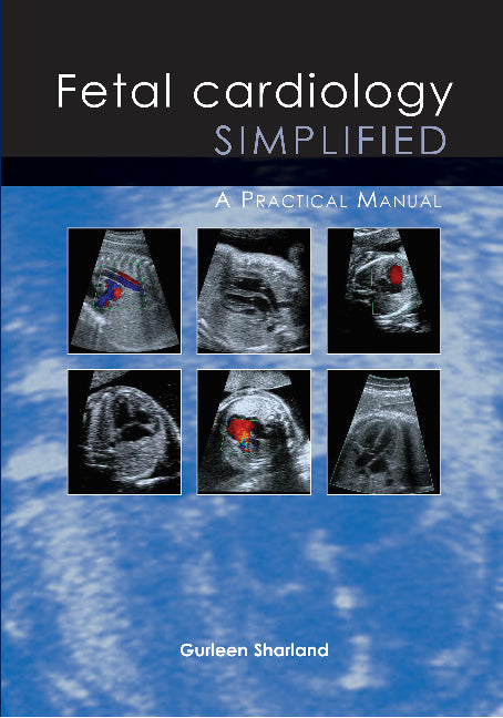 Fetal Cardiology Simplified