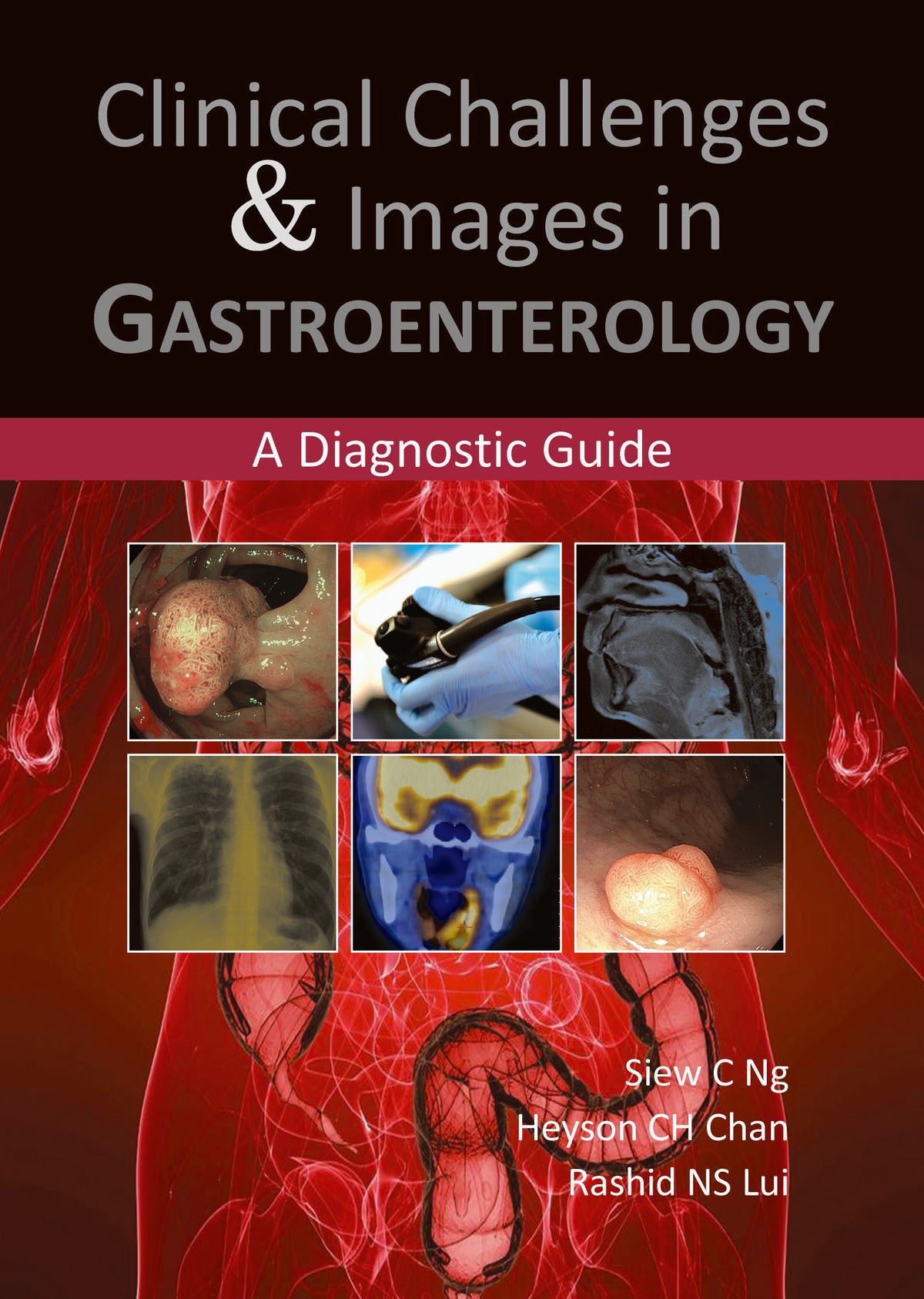 Clinical Challenges & Images in Gastroenterology