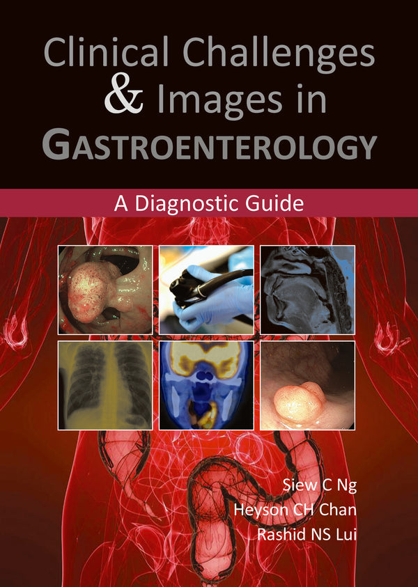 Clinical Challenges & Images in Gastroenterology