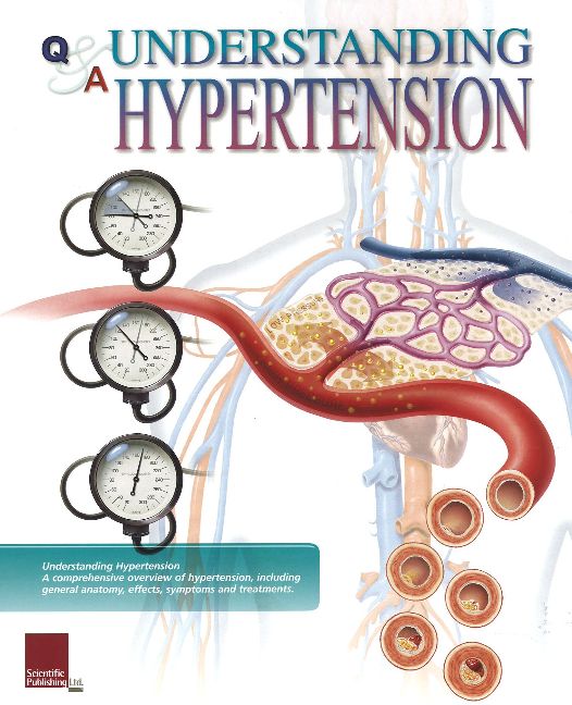 Understanding Hypertension Flip Chart